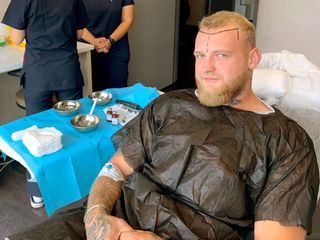 Re: Haartransplantation gegen Halbglatze