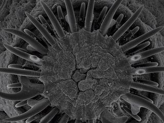 Der Feind in meinem Koerper