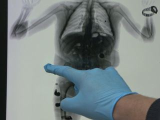 Border Patrol - Suedamerikas heisse Grenzen