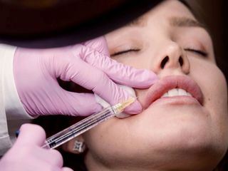 Alles fuer die Schoenheit - Perfektion dank Spritze und Skalpell