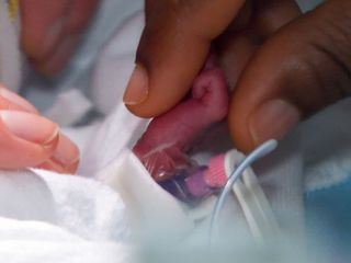 Kleines Leben - grosse Sorgen: Auf der Fruehchenstation