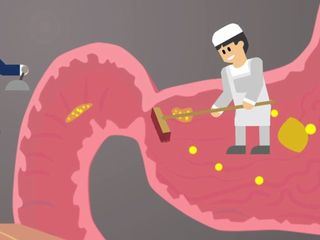 Vom Magen zum Dickdarm