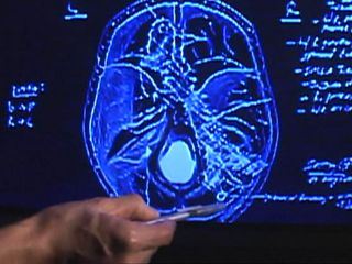 Autopsie - Mysterioese Todesfaelle